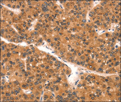 Anti-EPPIN antibody produced in rabbit affinity isolated antibody