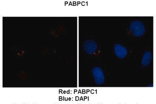 Anti-PABPC1 affinity isolated antibody