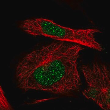 Anti-ITGB1BP1 antibody produced in rabbit Prestige Antibodies&#174; Powered by Atlas Antibodies, affinity isolated antibody