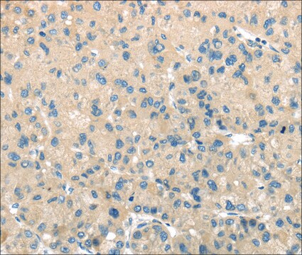 Anti-TMPRSS11A affinity isolated antibody