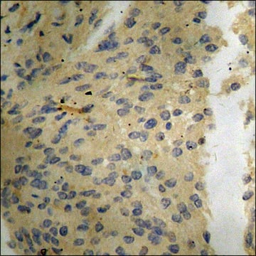 Anti-phospho-c-Jun (pSer73) antibody produced in rabbit affinity isolated antibody