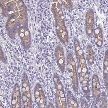 Anti-GLB1L2 antibody produced in rabbit Prestige Antibodies&#174; Powered by Atlas Antibodies, affinity isolated antibody, buffered aqueous glycerol solution