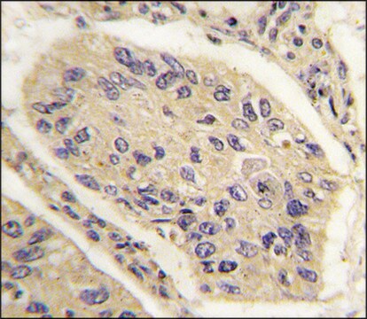 Anti-GHRH (N-term) antibody produced in rabbit saturated ammonium sulfate (SAS) precipitated, buffered aqueous solution