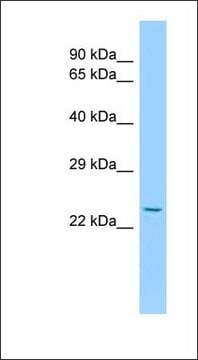 Anti-IL15RA antibody produced in rabbit affinity isolated antibody