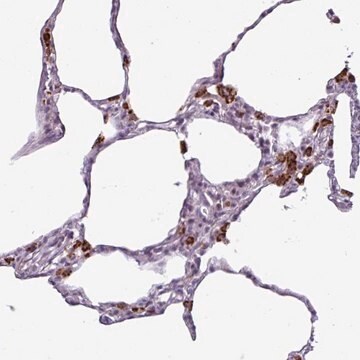 抗AMIGO2 ウサギ宿主抗体 Prestige Antibodies&#174; Powered by Atlas Antibodies, affinity isolated antibody, buffered aqueous glycerol solution