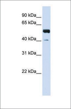 Anti-ZNF703 (ab2) antibody produced in rabbit affinity isolated antibody