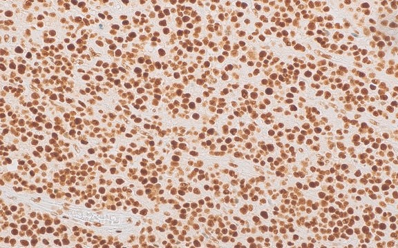 ATRX Rabbit Polyclonal Antibody