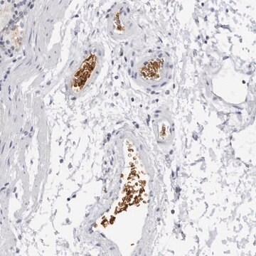 Anti-EPB41 antibody produced in rabbit Prestige Antibodies&#174; Powered by Atlas Antibodies, affinity isolated antibody, buffered aqueous glycerol solution