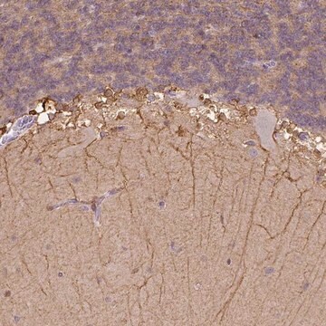 Anti-CACNB1 antibody produced in rabbit Prestige Antibodies&#174; Powered by Atlas Antibodies, affinity isolated antibody, buffered aqueous glycerol solution