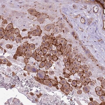 Anti-WDR90 antibody produced in rabbit Prestige Antibodies&#174; Powered by Atlas Antibodies, affinity isolated antibody, buffered aqueous glycerol solution