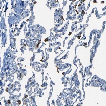 Anti-SLA antibody produced in rabbit Prestige Antibodies&#174; Powered by Atlas Antibodies, affinity isolated antibody, buffered aqueous glycerol solution