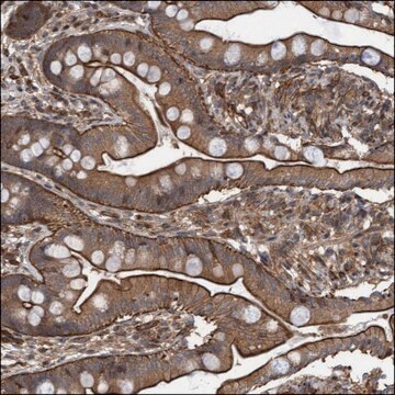 Anti-ROR2 antibody produced in rabbit Prestige Antibodies&#174; Powered by Atlas Antibodies, affinity isolated antibody, buffered aqueous glycerol solution