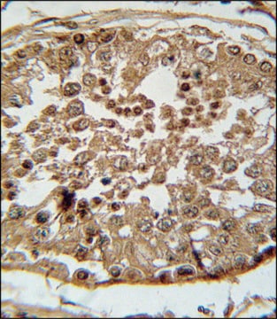 ANTI-SPAG1 (N-TERM) antibody produced in rabbit IgG fraction of antiserum, buffered aqueous solution