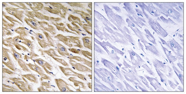 Anti-MRPL39 antibody produced in rabbit affinity isolated antibody