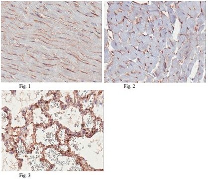 Anti-PTRF/cavin-1 Antibody from rabbit, purified by affinity chromatography