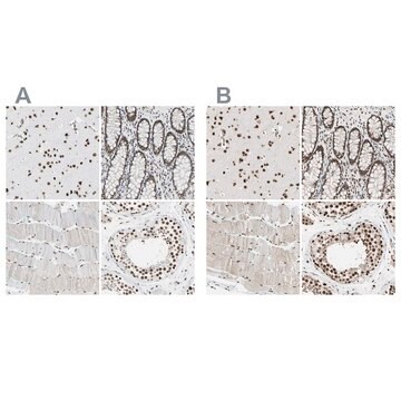 Anti-FAM98B antibody produced in rabbit Prestige Antibodies&#174; Powered by Atlas Antibodies, affinity isolated antibody, buffered aqueous glycerol solution