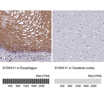 Anti-S100A11 antibody produced in rabbit Prestige Antibodies&#174; Powered by Atlas Antibodies, affinity isolated antibody, buffered aqueous glycerol solution