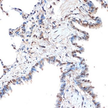 Anti-CoREST/RCOR1 antibody produced in rabbit