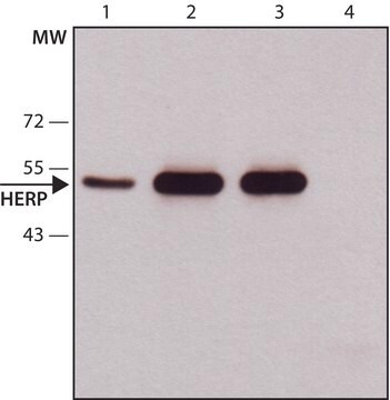 Anti-Herp (N-terminal) antibody produced in rabbit ~1.0&#160;mg/mL, affinity isolated antibody, buffered aqueous solution