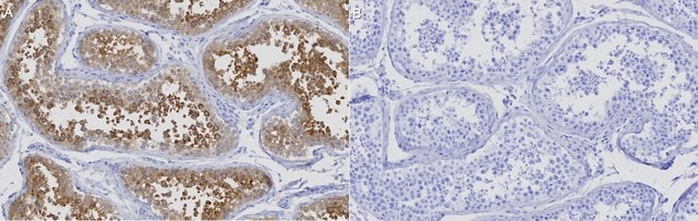 Anti-LZTFL1 Antibody, clone 1I2 ZooMAb&#174; Rabbit Monoclonal recombinant, expressed in HEK 293 cells