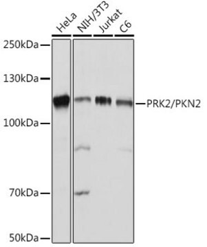 Anti-PRK2/PKN2 Antibody, clone 5O2G6, Rabbit Monoclonal