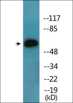 Anti-phospho-Lck (pTyr393) antibody produced in rabbit affinity isolated antibody