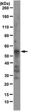 Anticorpo anti-Fox1, clone D8F8 clone D8F8, from mouse