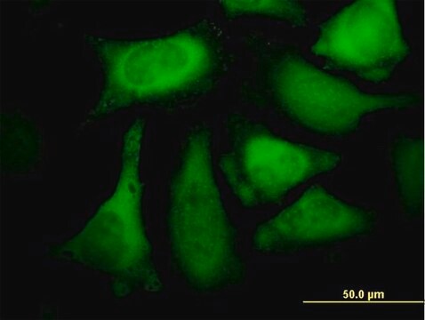 Anti-CACYBP antibody produced in mouse purified immunoglobulin, buffered aqueous solution