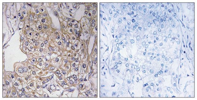 Anti-TNXB antibody produced in rabbit affinity isolated antibody