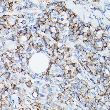 Anti-CD8A antibody produced in rabbit