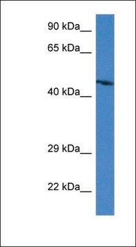 Anti-ABRA antibody produced in rabbit affinity isolated antibody