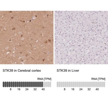 Anti-STK39 antibody produced in rabbit Prestige Antibodies&#174; Powered by Atlas Antibodies, affinity isolated antibody, buffered aqueous glycerol solution