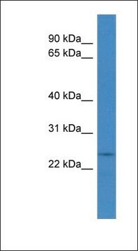 Anti-CYHR1 antibody produced in rabbit affinity isolated antibody