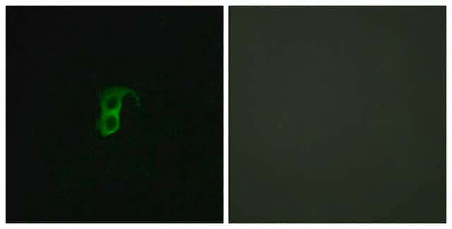 Anti-GPR87 antibody produced in rabbit affinity isolated antibody