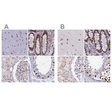 Anti-NOL4L antibody produced in rabbit Prestige Antibodies&#174; Powered by Atlas Antibodies, affinity isolated antibody, buffered aqueous glycerol solution