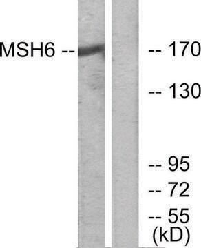 Anti-MSH6 antibody produced in rabbit affinity isolated antibody