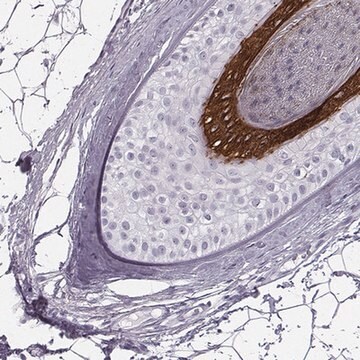 Anti-KRT74 antibody produced in rabbit Prestige Antibodies&#174; Powered by Atlas Antibodies, affinity isolated antibody, buffered aqueous glycerol solution