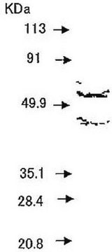 Anti-MMP-1 (Ab-1) Mouse mAb (41-1E5) liquid, clone 41-1E5, Calbiochem&#174;