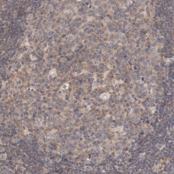 ZNF597 antibody Immunohistochemistry HPA001556