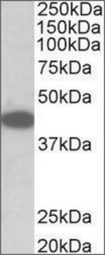 Anti-Trib1 antibody produced in goat affinity isolated antibody, buffered aqueous solution