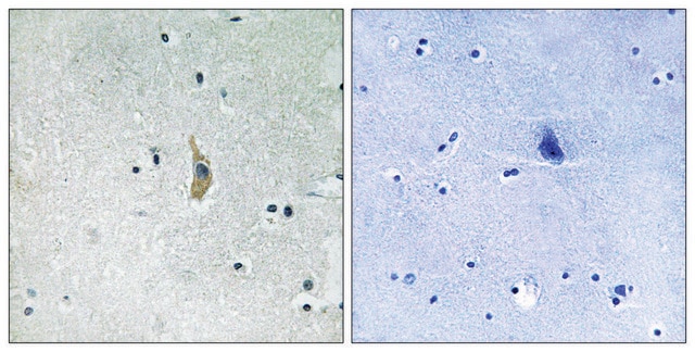 Anti-PSEN1 antibody produced in rabbit affinity isolated antibody