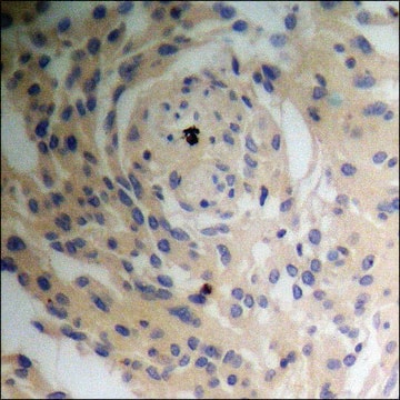 Anti-phospho-Tuberin/TSC2 (pSer939) antibody produced in rabbit affinity isolated antibody