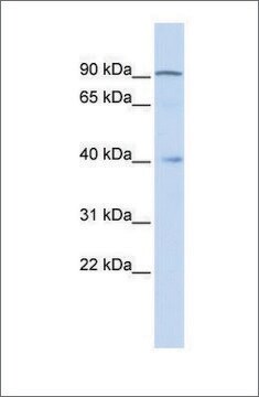 Anti-ZNF263 (ab2) antibody produced in rabbit affinity isolated antibody