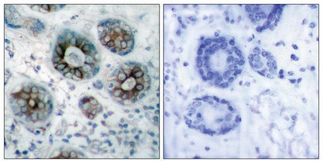 Anti-GAP43 antibody produced in rabbit affinity isolated antibody