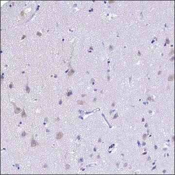 Anti-DDN antibody produced in rabbit Prestige Antibodies&#174; Powered by Atlas Antibodies, affinity isolated antibody, buffered aqueous glycerol solution