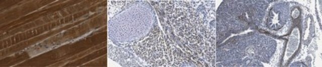 Anticorps anti-MUSTN1 from rabbit, purified by affinity chromatography