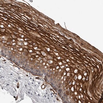 Anti-C1orf216 antibody produced in rabbit Prestige Antibodies&#174; Powered by Atlas Antibodies, affinity isolated antibody, buffered aqueous glycerol solution