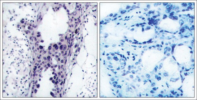 Anti-PTEN (Ab-380/382/383) antibody produced in rabbit affinity isolated antibody