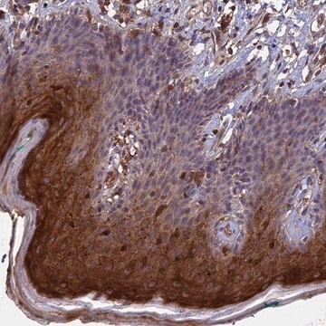 Anti-RASAL1 antibody produced in rabbit Prestige Antibodies&#174; Powered by Atlas Antibodies, affinity isolated antibody, buffered aqueous glycerol solution