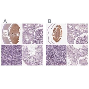 Anti-BFSP1 antibody produced in rabbit Prestige Antibodies&#174; Powered by Atlas Antibodies, affinity isolated antibody, buffered aqueous glycerol solution